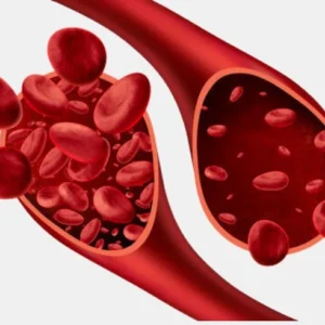 ANAEMIA PROFILE Elite Diagnostics, Dr. Santosh Kondapalli