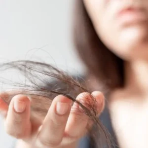 ELITE HAIRFALL PROFILE Elite Diagnostics, Dr. Santosh Kondapalli