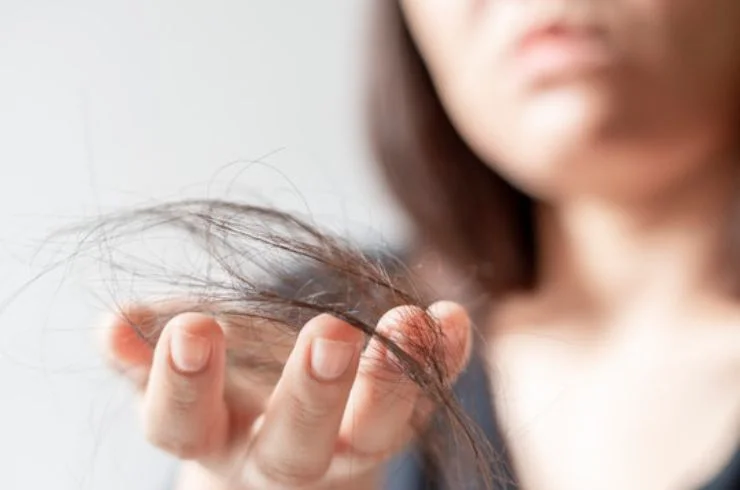 ELITE HAIRFALL PROFILE Elite Diagnostics, Dr. Santosh Kondapalli