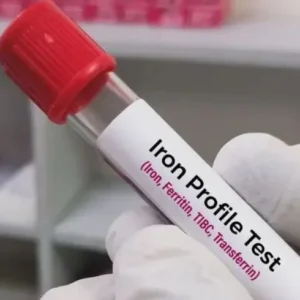 IRON PROFILE Elite Diagnostics, Dr. Santosh Kondapalli