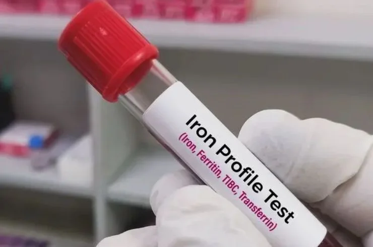 IRON PROFILE Elite Diagnostics, Dr. Santosh Kondapalli