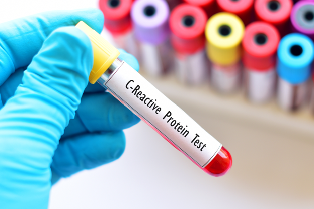 Elite Diagnostics, Dr. Santosh Kondapalli