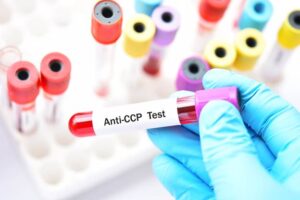 Elite Diagnostics, Dr. Santosh Kondapalli